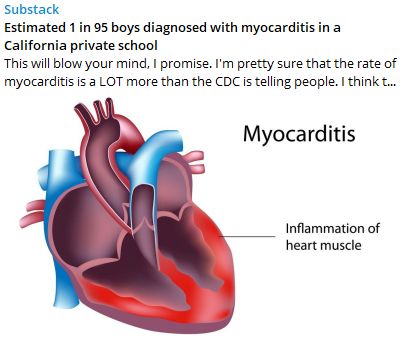 1 in 95 Myocarditis